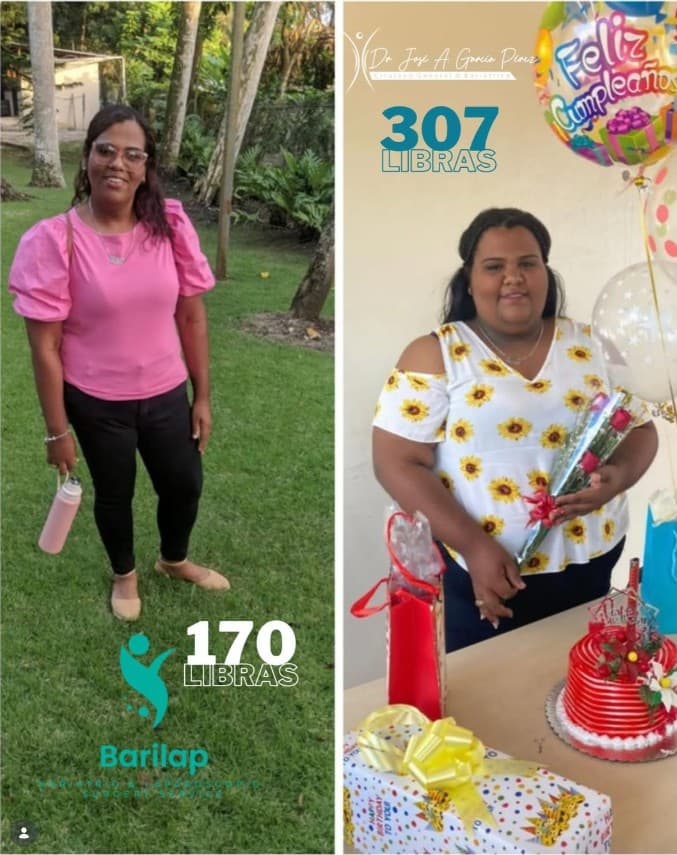 Antes y después de una paciente de la unidad