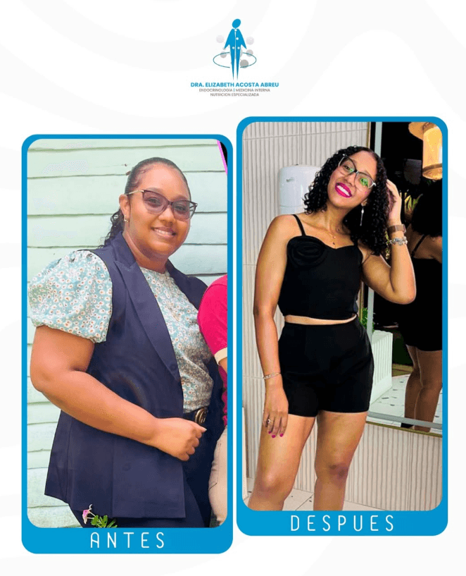 Antes y después de Ananda Carlina Núñez Guaba